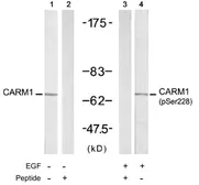 Anti-CARM1 (phospho Ser228) antibody used in Western Blot (WB). GTX79118
