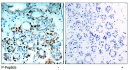 Anti-Bim (phospho Ser69/Ser65) antibody used in IHC (Paraffin sections) (IHC-P). GTX79122