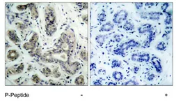 Anti-Bad (phospho Ser136) antibody used in IHC (Paraffin sections) (IHC-P). GTX79125