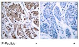 Anti-Bad (phospho Ser155) antibody used in IHC (Paraffin sections) (IHC-P). GTX79126