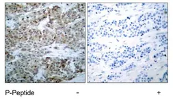 Anti-Bad (phospho Ser112) antibody used in IHC (Paraffin sections) (IHC-P). GTX79127