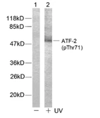 Anti-ATF2 (phospho Thr71) antibody used in Western Blot (WB). GTX79133