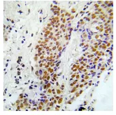 Anti-ASK1 (phospho Ser966) antibody used in IHC (Paraffin sections) (IHC-P). GTX79136