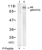 Anti-Androgen Receptor (phospho Ser213) antibody used in Western Blot (WB). GTX79140