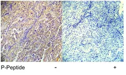 Anti-AMPK beta 1 (phospho Ser182) antibody used in IHC (Paraffin sections) (IHC-P). GTX79141