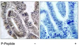 Anti-AMPK1/AMPK2 (phospho Ser485/Ser491) antibody used in IHC (Paraffin sections) (IHC-P). GTX79142