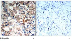 Anti-AMPK alpha 1 (phospho Thr174) antibody used in IHC (Paraffin sections) (IHC-P). GTX79143