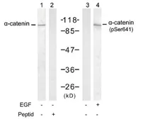 Anti-alpha 1 Catenin (phospho Ser641) antibody used in Western Blot (WB). GTX79145