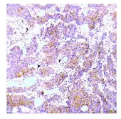 Anti-ALK (phospho Tyr1586) antibody used in IHC (Paraffin sections) (IHC-P). GTX79146