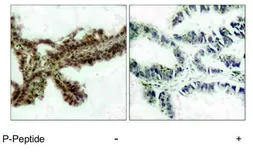 Anti-AKT (phospho Thr308) antibody used in IHC (Paraffin sections) (IHC-P). GTX79150