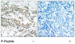 Anti-FOXO4 (phospho Ser197) antibody used in IHC (Paraffin sections) (IHC-P). GTX79151