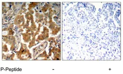 Anti-alpha Adducin (phospho Ser726) antibody used in IHC (Paraffin sections) (IHC-P). GTX79152