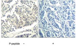 Anti-c-Abl (phospho Tyr393/Tyr429) antibody used in IHC (Paraffin sections) (IHC-P). GTX79153