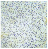 Anti-c-Abl (phospho Tyr204) antibody used in IHC (Paraffin sections) (IHC-P). GTX79154