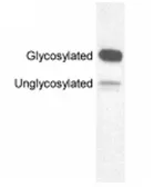 Anti-Melanopsin antibody used in Western Blot (WB). GTX79191