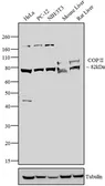 Anti-SEC23A antibody used in Western Blot (WB). GTX79203