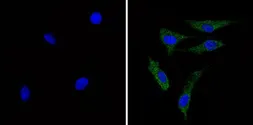 Anti-Recoverin antibody [6a55 cd6] used in Immunocytochemistry/ Immunofluorescence (ICC/IF). GTX79211