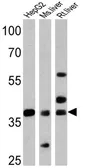 Anti-FOXA3 antibody used in Western Blot (WB). GTX79266
