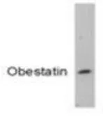 Anti-Obestatin antibody used in Western Blot (WB). GTX79314