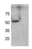Anti-GRASP55 antibody used in Western Blot (WB). GTX79324