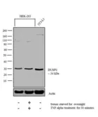 Anti-DUSP2 antibody used in Western Blot (WB). GTX79395