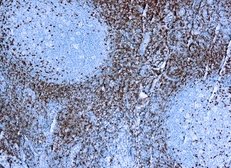 Anti-CD5 antibody [SP19] used in IHC (Paraffin sections) (IHC-P). GTX79414