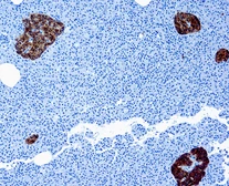 Anti-Chromogranin A antibody [SP12] used in IHC (Paraffin sections) (IHC-P). GTX79418