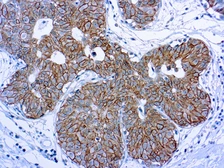 Anti-Her2 / ErbB2 antibody [SP3] (ready-to-use) used in IHC (Paraffin sections) (IHC-P). GTX79425