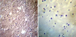 Anti-HCN3 antibody [TLL6C5] used in IHC (Paraffin sections) (IHC-P). GTX79455