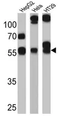 Anti-CYP3A7 antibody [F19 P2 H2] used in Western Blot (WB). GTX79463
