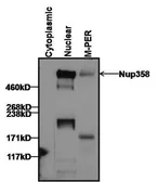 Anti-RANBP2 antibody [2E1] used in Western Blot (WB). GTX79468