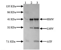 Anti-uPA antibody used in Western Blot (WB). GTX79597