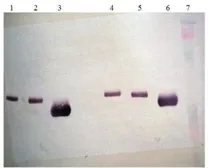 Anti-Renin antibody [7D3-E3] used in Western Blot (WB). GTX79644