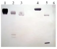 Anti-Plasminogen antibody [4G6-B11] used in Western Blot (WB). GTX79690