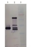 Anti-PAI-1 antibody used in Western Blot (WB). GTX79739