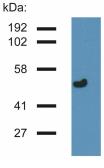 Anti-gamma Tubulin antibody [TU-32] used in Western Blot (WB). GTX79860