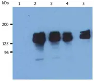 Anti-SHIP1 antibody [SHIP-01] used in Western Blot (WB). GTX79894