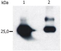 Anti-GST tag antibody [S-tag-05] used in Western Blot (WB). GTX79895