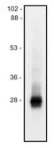 Anti-LIME antibody [mLIME-05] used in Western Blot (WB). GTX79915