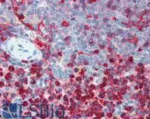 Anti-CD18 antibody [MEM-48] (PE) used in IHC (Paraffin sections) (IHC-P). GTX79945