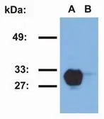 Anti-HLA-DR1 antibody [MEM-267] (PE) used in Western Blot (WB). GTX79956