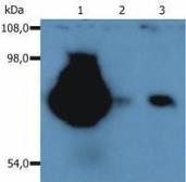 Anti-CD44 antibody [MEM-263] (PE) used in Western Blot (WB). GTX79959