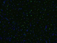 Anti-CD105 antibody [MEM-229] (FITC) used in Immunocytochemistry/ Immunofluorescence (ICC/IF). GTX79974