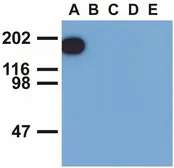 Anti-EGFR (phospho Tyr1173) antibody [EM-13] used in Western Blot (WB). GTX80161