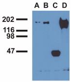 Anti-EGFR (phospho Tyr1173) antibody [EM-13] used in Immunoprecipitation (IP). GTX80161