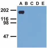 Anti-EGFR (phospho Tyr992) antibody [EM-12] used in Western Blot (WB). GTX80162