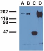 Anti-EGFR (phospho Tyr992) antibody [EM-12] used in Immunoprecipitation (IP). GTX80162