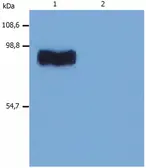 Anti-STIM1 antibody [CDN3H4] used in Western Blot (WB). GTX80195
