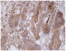 Anti-CD66e antibody [CB30] used in IHC (Paraffin sections) (IHC-P). GTX80201