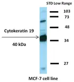 Anti-Cytokeratin 19 antibody [BA-17] (Biotin) used in Western Blot (WB). GTX80226